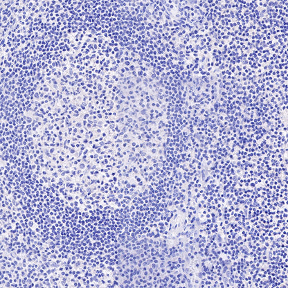 Cadherin 17 Recombinant Rabbit mAb,PBS Only (SDT-R151)