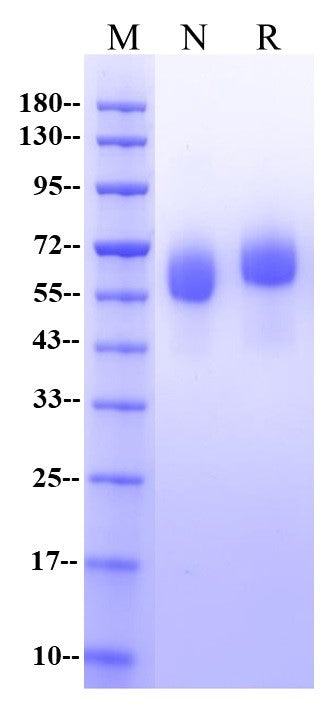 FGF-R1/CD331 His Tag Protein, Human