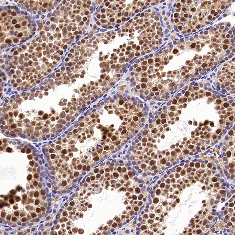 USP5 Rabbit Polyclonal Antibody