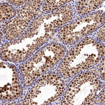 USP5 Rabbit Polyclonal Antibody