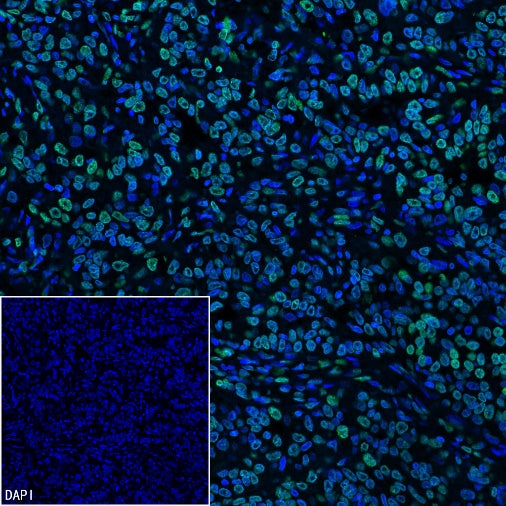 Histone H3 (tri methyl K9) Recombinant Rabbit mAb (S-3826)