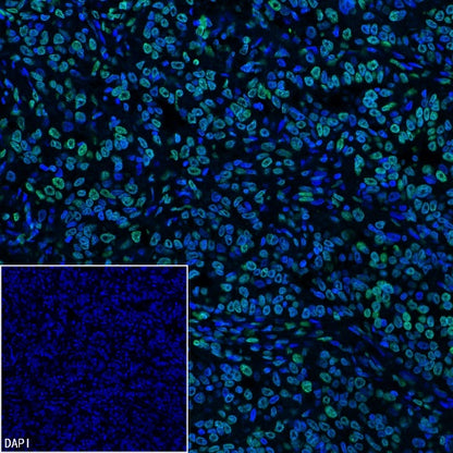Histone H3 (tri methyl K9) Recombinant Rabbit mAb (S-3826)