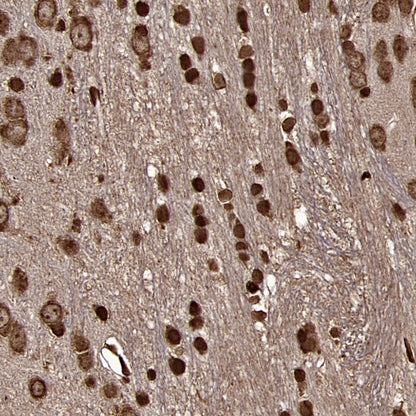 Superoxide dismutase Rabbit Polyclonal Antibody