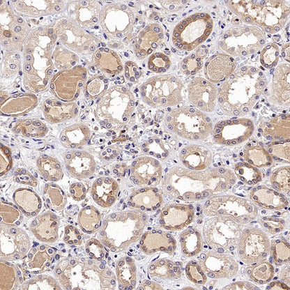 NF-κB2 p100 Recombinant Rabbit mAb (S-2502-62)