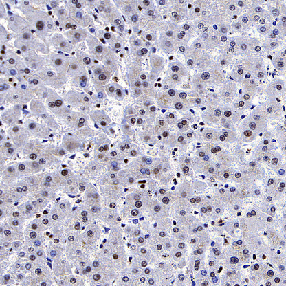 RBBP4 Rabbit Polyclonal Antibody