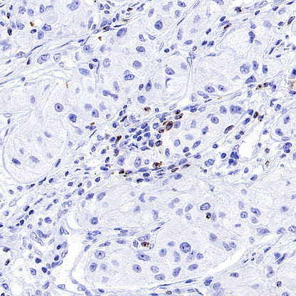 LAG3 Recombinant Rabbit mAb (S-671-74)