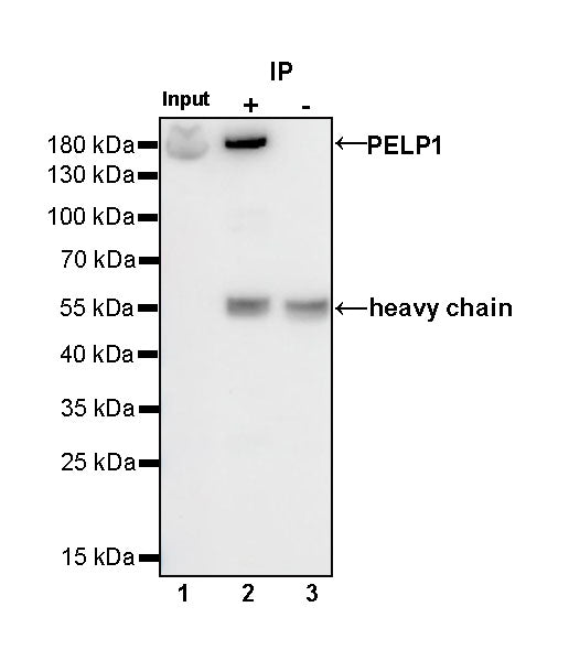 PELP1 Recombinant Rabbit mAb (S-756-22)