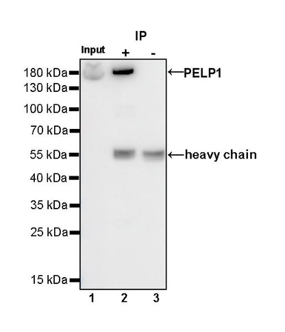 PELP1 Recombinant Rabbit mAb (S-756-22)