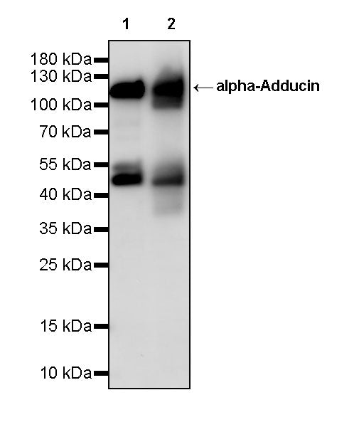 alpha-Adducin Recombinant Rabbit mAb (S-5283)