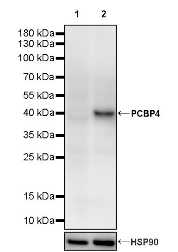 PCBP4 Recombinant Rabbit mAb (S-3107-175)