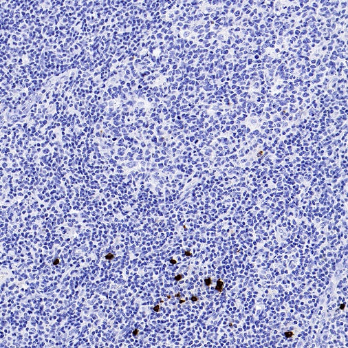Human IgG4 Recombinant Rabbit mAb (S-1140-53)