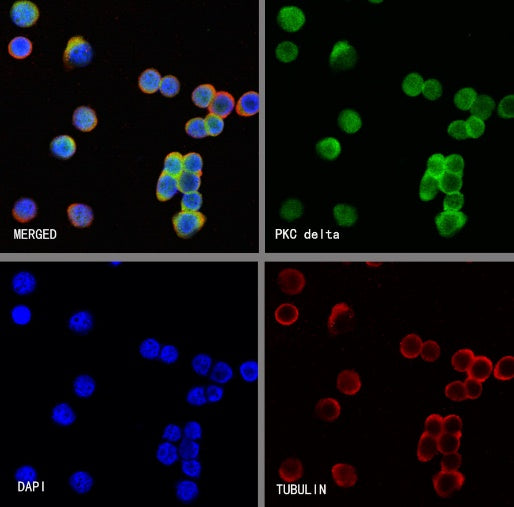 PKC delta Recombinant Rabbit mAb (S-2611-39)