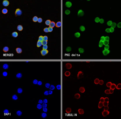 PKC delta Recombinant Rabbit mAb (S-2611-39)