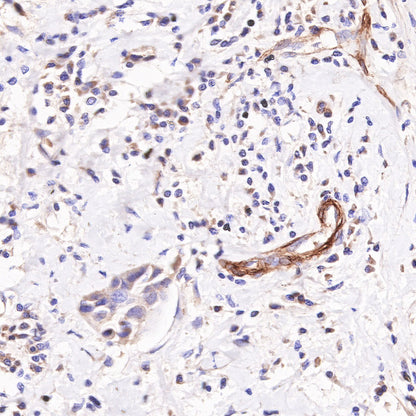 CD146 Recombinant Rabbit mAb (SDT-348-6)