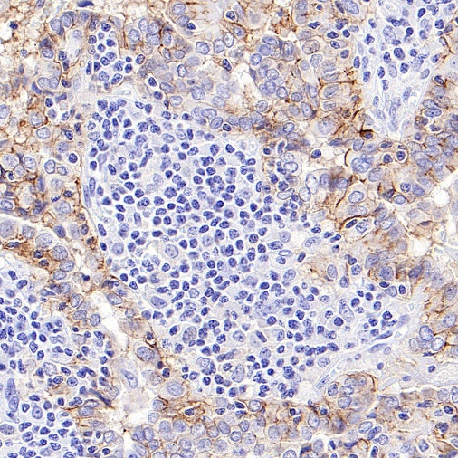 CD44v6 Mouse mAb (S-945-76)