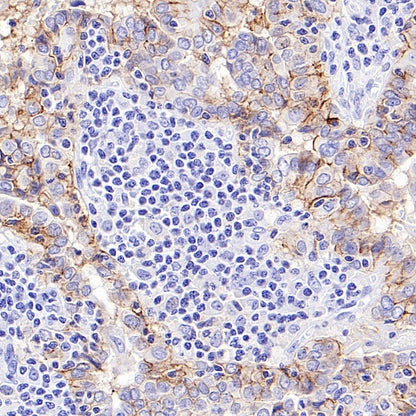 CD44v6 Mouse mAb (S-945-76)