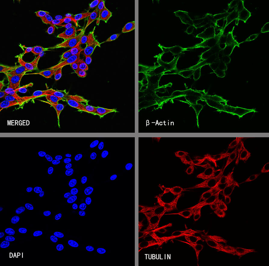 β-Actin Recombinant Rabbit mAb (S-5701)