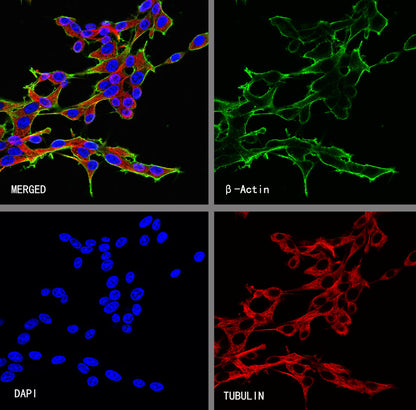 β-Actin Recombinant Rabbit mAb (S-5701)