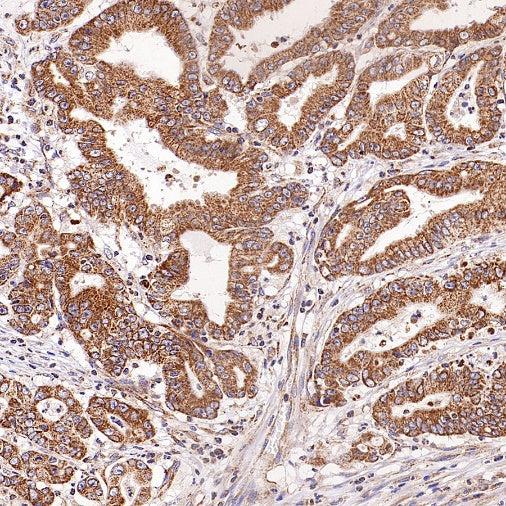 SFXN1/TCC Rabbit Polyclonal Antibody
