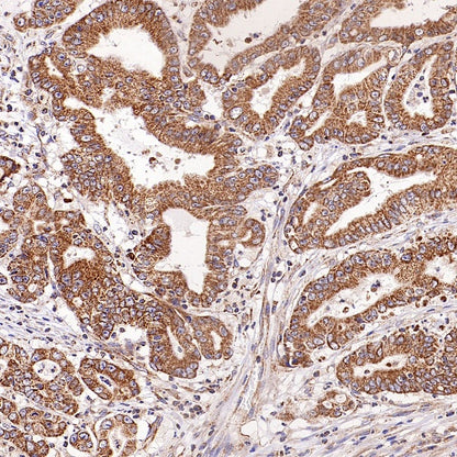SFXN1/TCC Rabbit Polyclonal Antibody