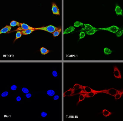 DCAMKL1 Recombinant Rabbit mAb (S-1705-76)