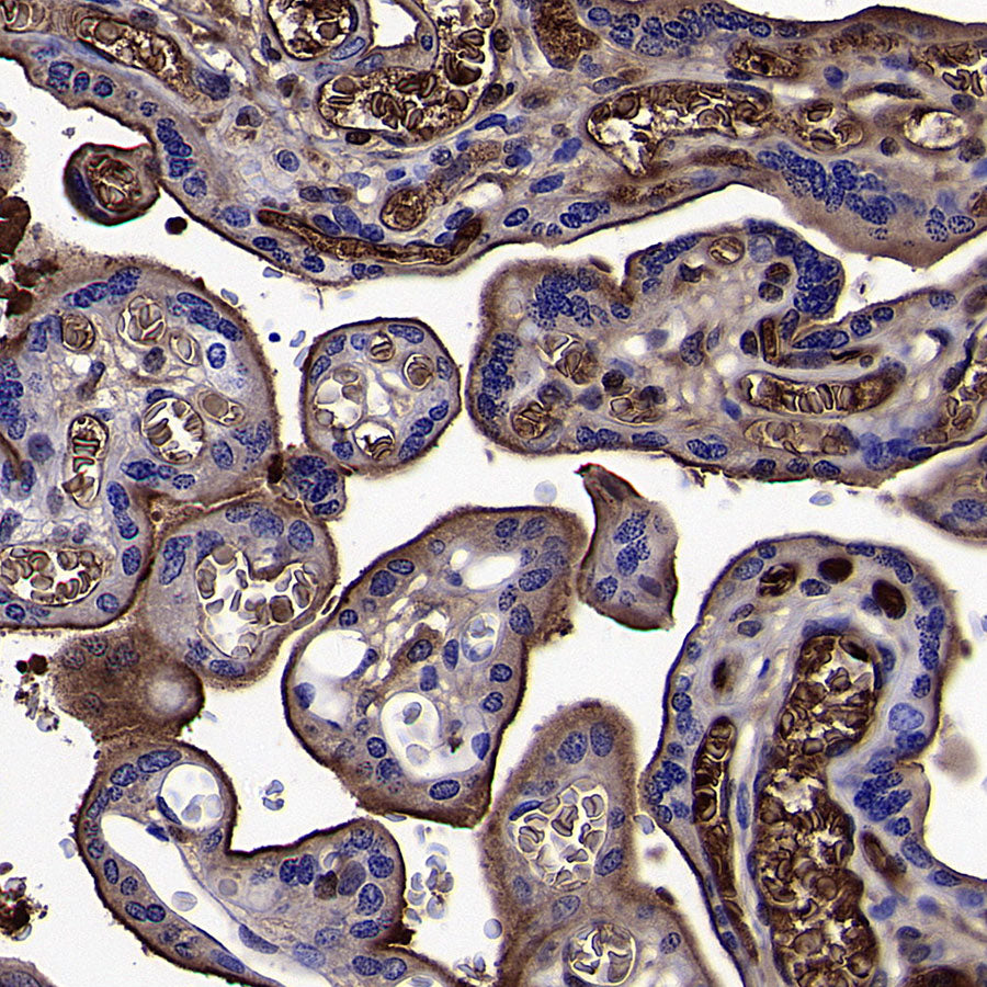 Apolipoprotein CIII Recombinant Rabbit mAb (S-5408)