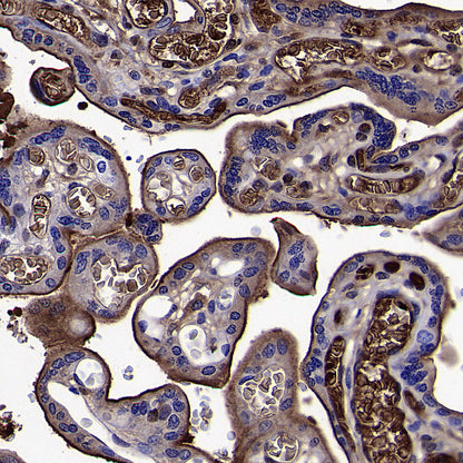 Apolipoprotein CIII Recombinant Rabbit mAb (S-5408)