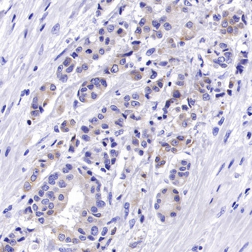Bcl-xL Recombinant Rabbit mAb (S-487-28)