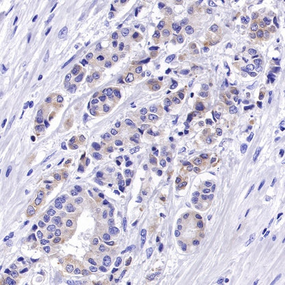 Bcl-xL Recombinant Rabbit mAb (S-487-28)