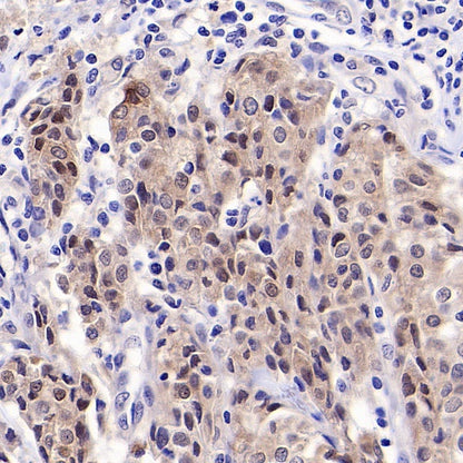 MYG1 Recombinant Rabbit mAb (S-2248-25)