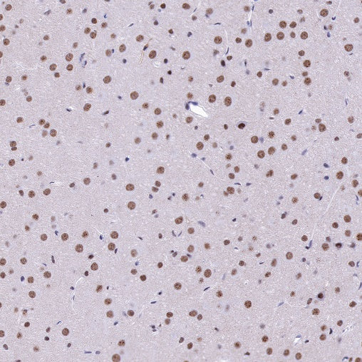 U2AF2 Recombinant Rabbit mAb (S-1324-1)