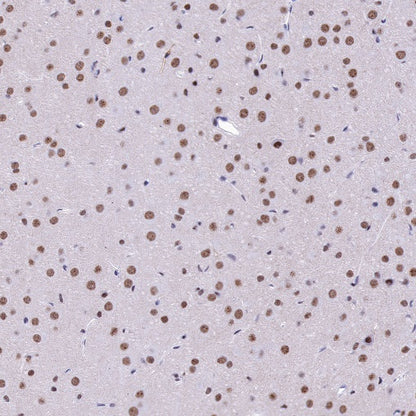 U2AF2 Recombinant Rabbit mAb (S-1324-1)