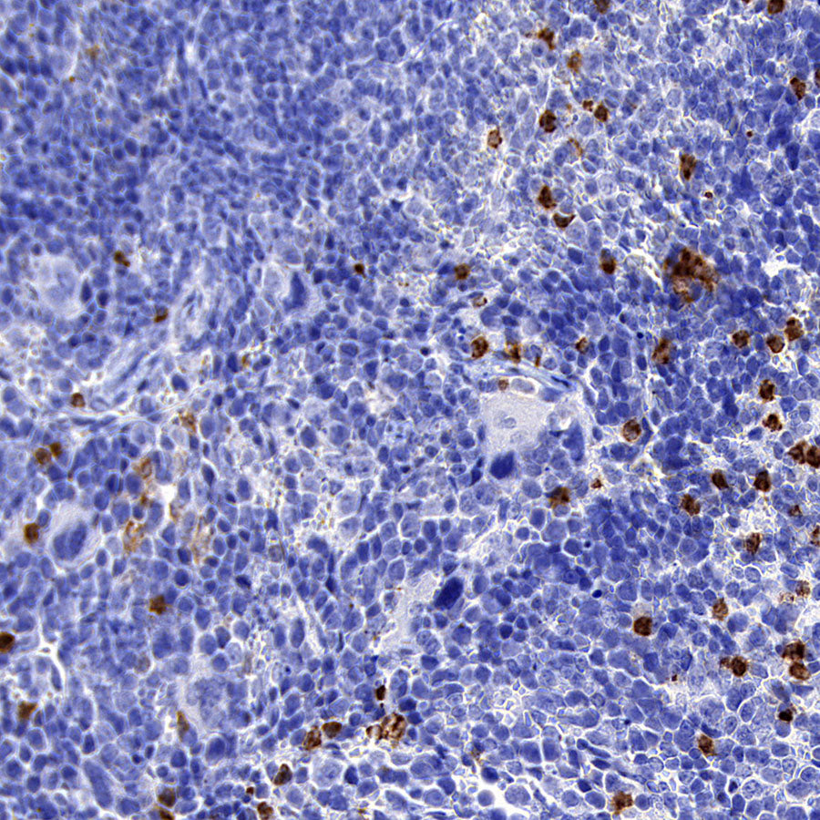 CD177 Rabbit Polyclonal Antibody