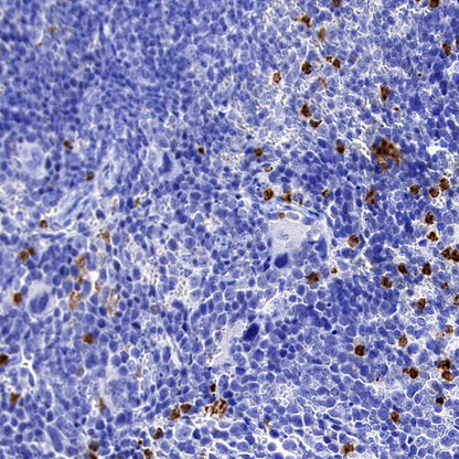 CD177 Rabbit Polyclonal Antibody