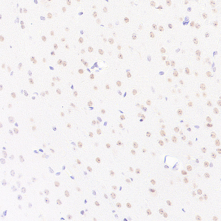 BAP1 Recombinant Rabbit mAb (S-6199)