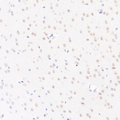 BAP1 Recombinant Rabbit mAb (S-6199)