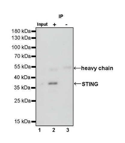 STING Recombinant Rabbit mAb (SDT-R150)