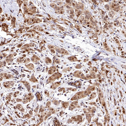 PBEF/Visfatin/NAMPT Rabbit Polyclonal Antibody