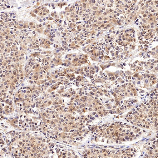 eIF4E Rabbit Polyclonal Antibody