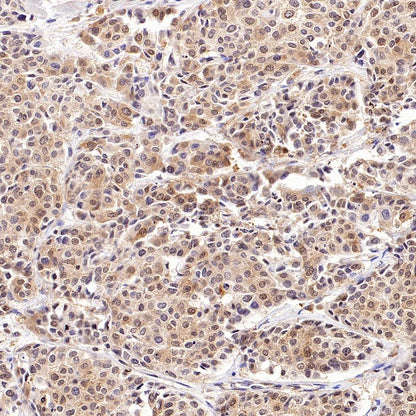 eIF4E Rabbit Polyclonal Antibody