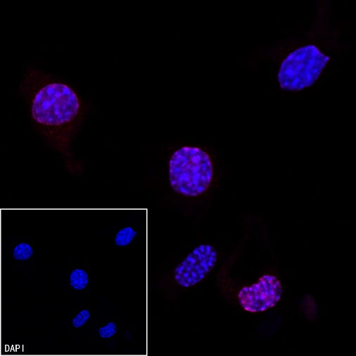 Ki67 Recombinant Rabbit mAb (Alexa Fluor® 555 Conjugate) (SDT-R459)