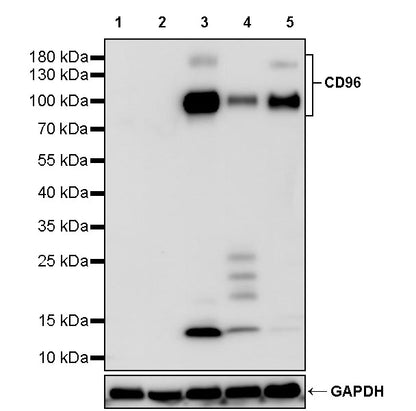 CD96 Recombinant Rabbit mAb (S-5322)