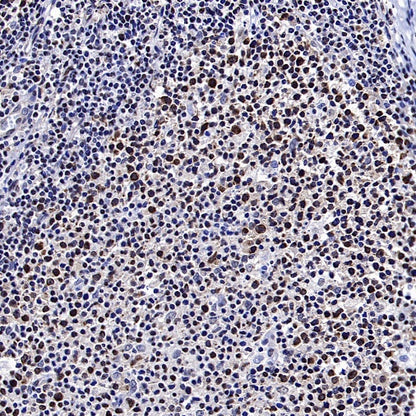 FUS Recombinant Rabbit mAb (S-1015-21)