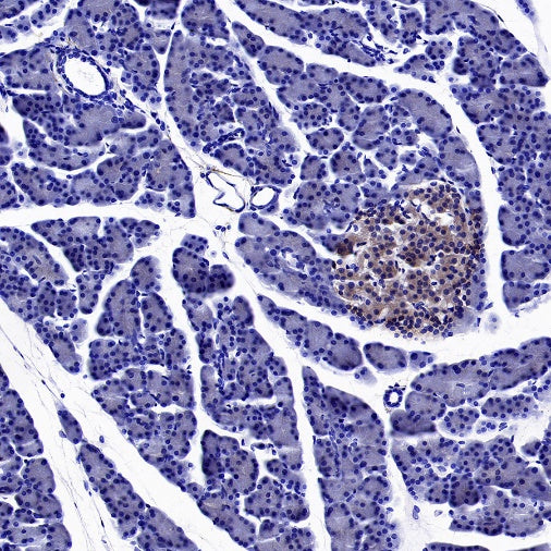 GAD65 Recombinant Rabbit mAb (S-2318-47)