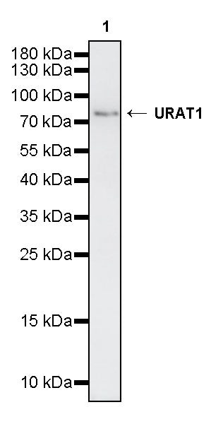 URAT1 Recombinant Rabbit mAb