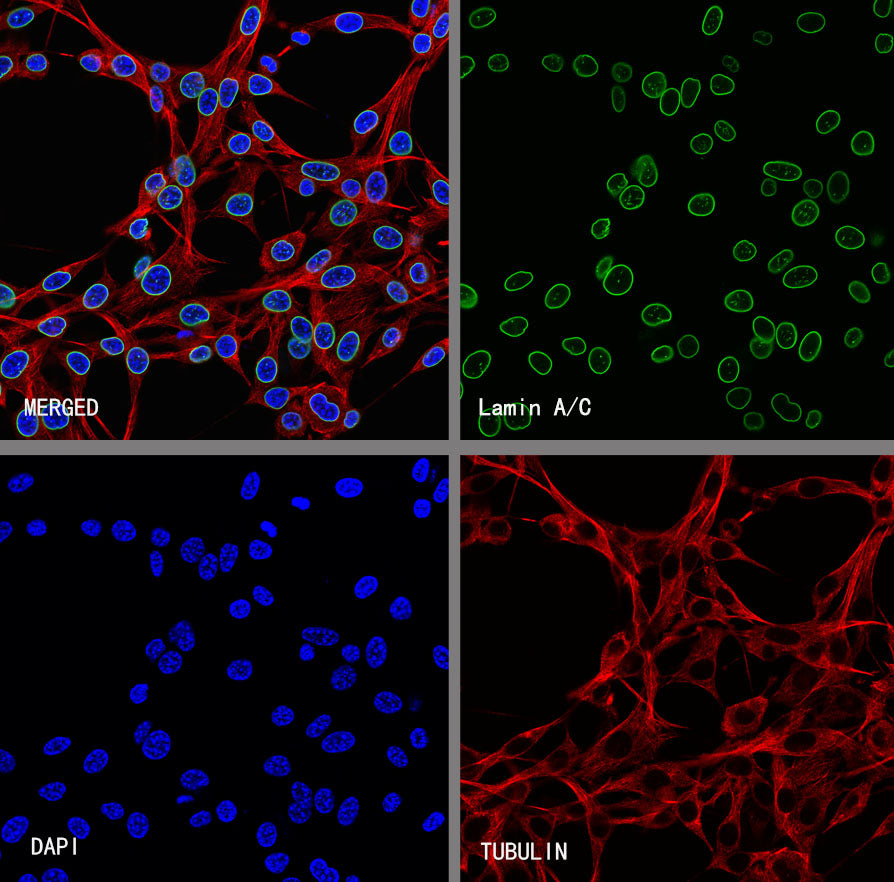 Lamin A/C Recombinant Rabbit mAb (S-5671)