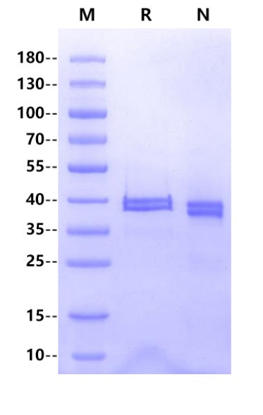 ACVR2A His Tag Protein, Human