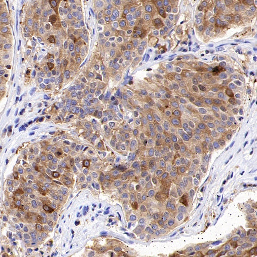 Ezrin Recombinant Rabbit mAb (S-1894-4)