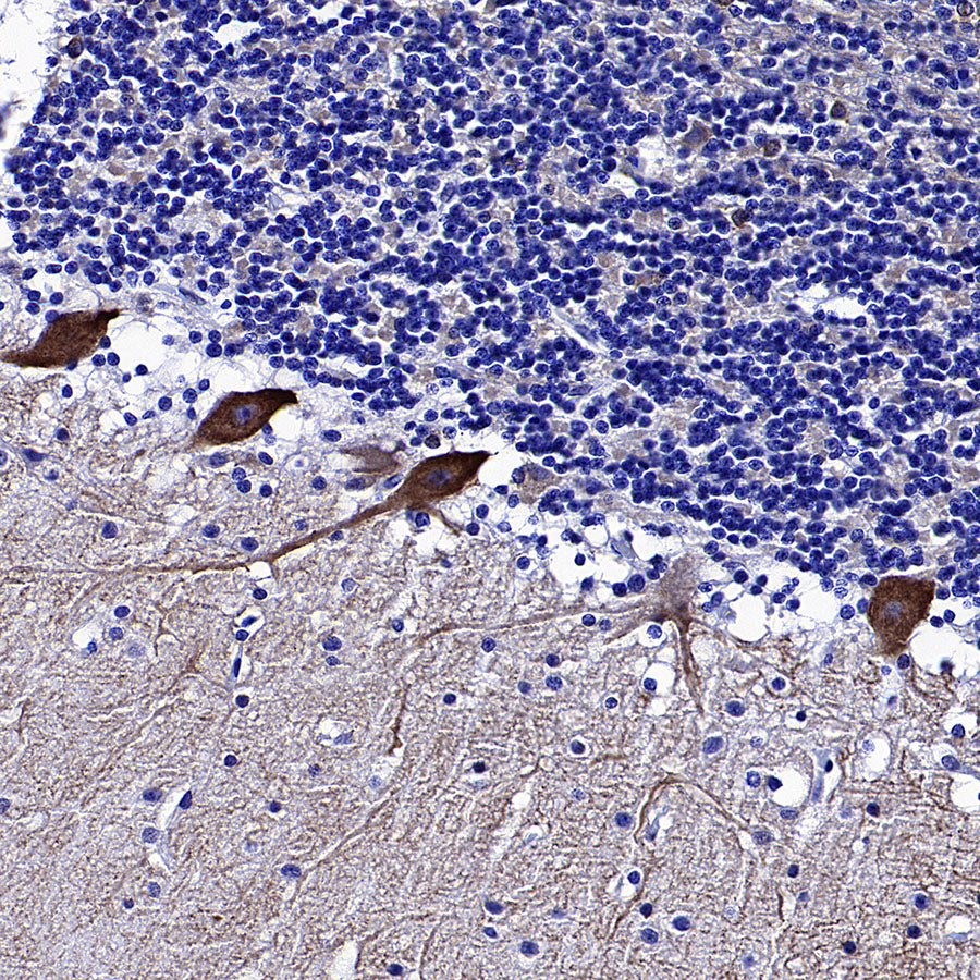 STK39 Recombinant Rabbit mAb (S-3630-15)