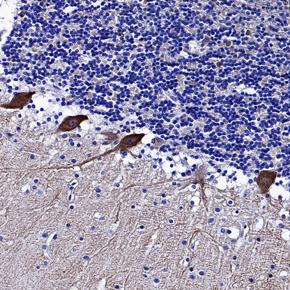STK39 Recombinant Rabbit mAb (S-3630-15)